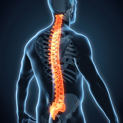 Medical Illustration of an Inflamed Spine