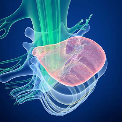 Medical Illustration of Bulging Discs
