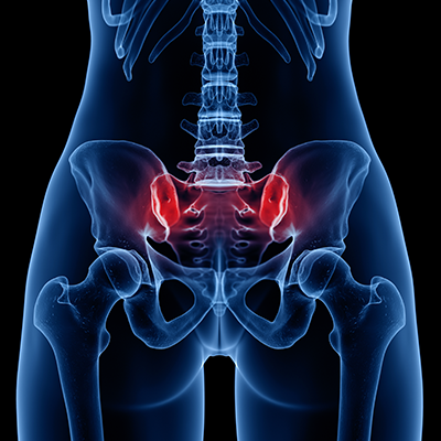 Sacroiliac is Painful; Chiropractic Offers Gentle Solutions – Chiropractic BioPhysics