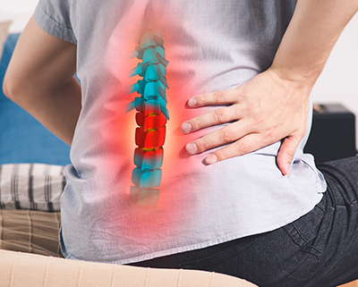 Common Causes Of Spondylolisthesis And What They Mean For Your Body ...