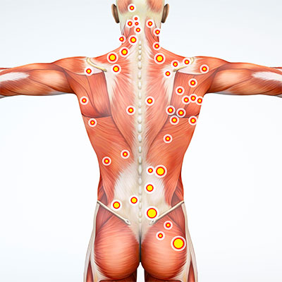 Breakdown Of Scar Tissue - Benefits Of Massage - Massage - Treatments 