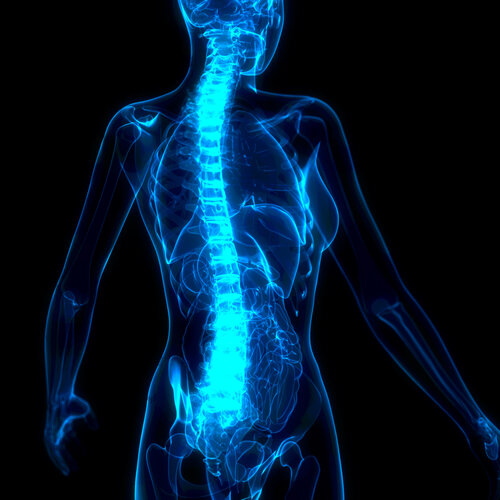 Suffering from scoliosis? Chiropractic BioPhysics® Can Help.