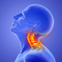 Neck-Pain-Cervical-Subluxations-The-Role-of-Chiropractic-BioPhysics