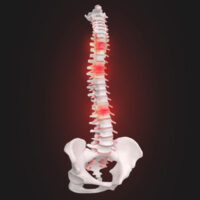 How CBP Can Slow Down Spinal Degeneration and Improve Disc Health