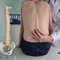 Spinal Deformity vs. Structural Shift