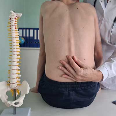 Spinal Deformity vs. Structural Shift